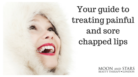 A woman smiling and looking above, with sentence at the right that says, "your guide to treating painful and sore chapped lips"